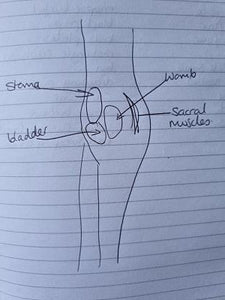 Other Complications With Surgery