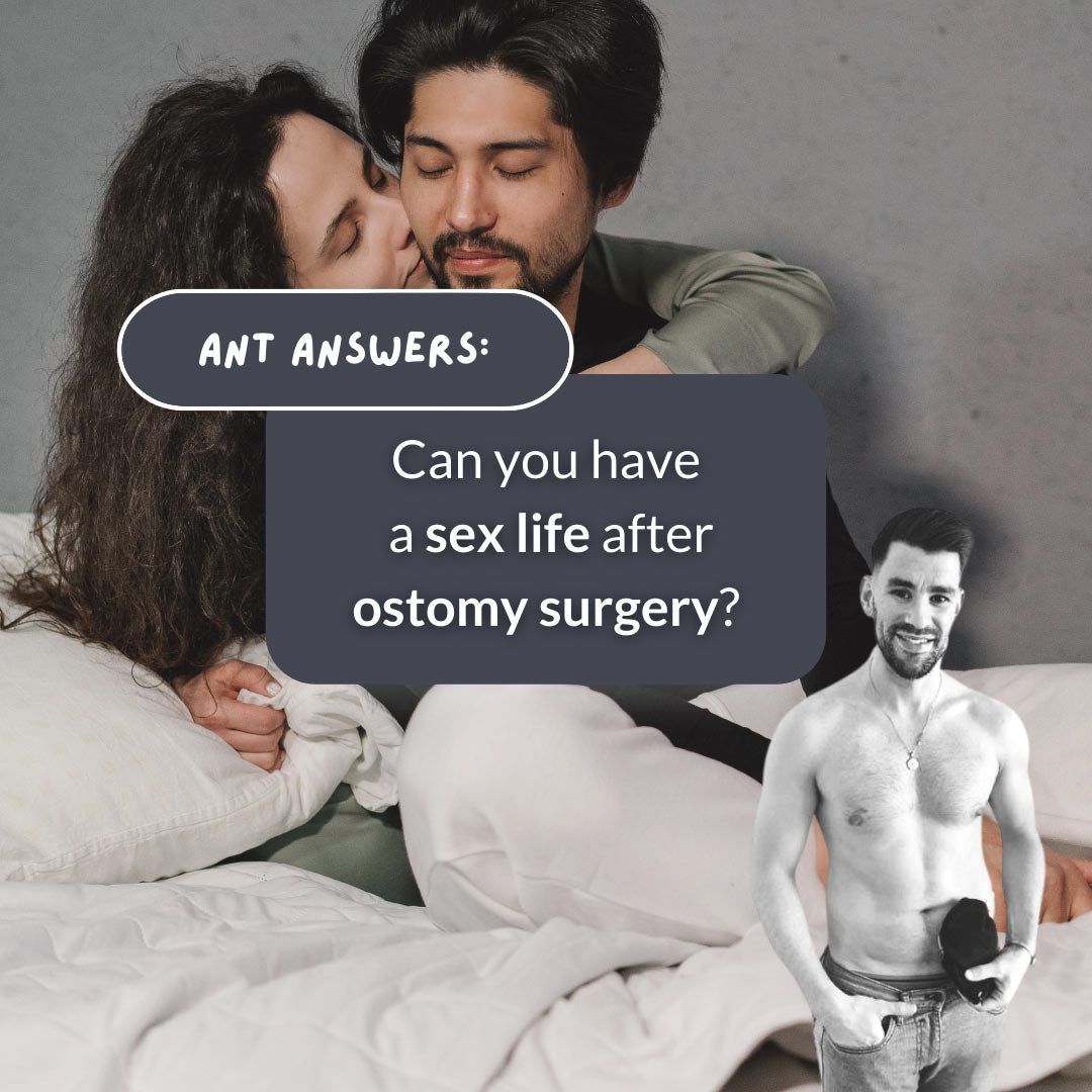 Can you have a sex life after stoma surgery?