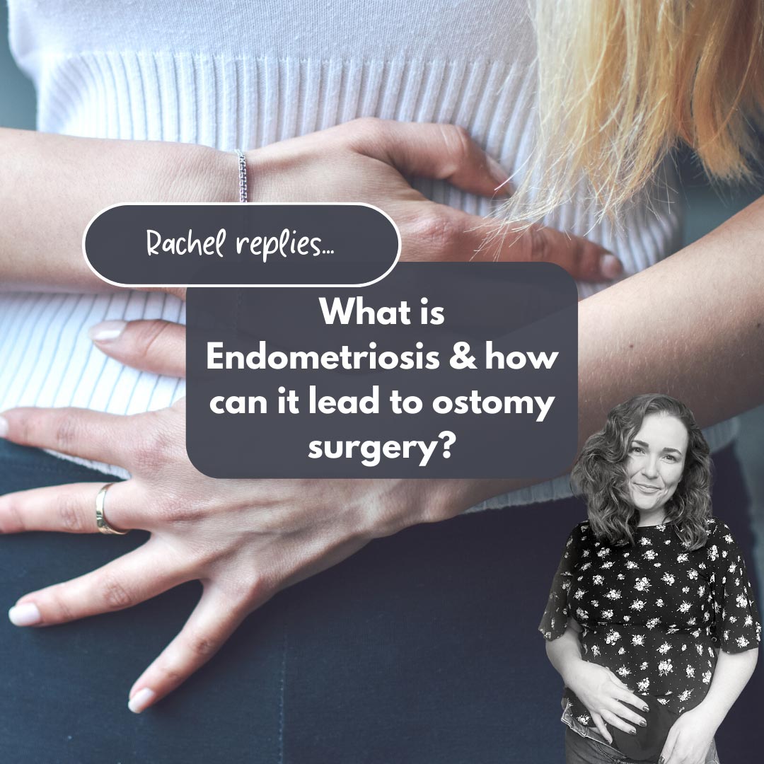 What is Endometriosis & how can it lead to ostomy surgery?
